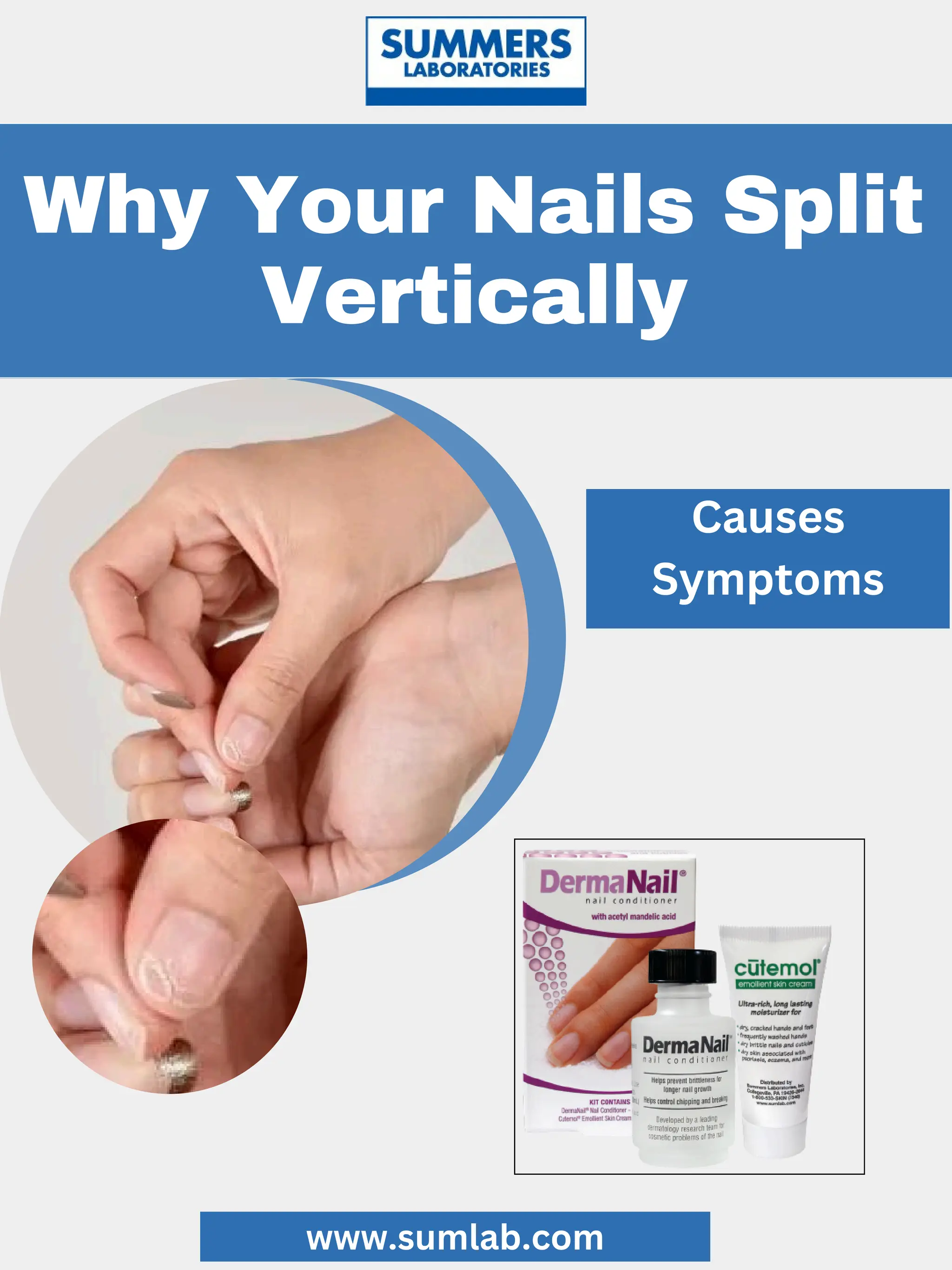 What deficiency causes nails to split vertically? PDF
