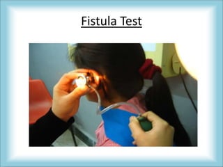 Fistula Test
 