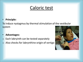 Caloric test
• Principle:
To induce nystagmus by thermal stimulation of the vestibular
system
• Advantages:
o Each labryinth can be tested separately
o Also checks for labrynthine origin of vertigo
 