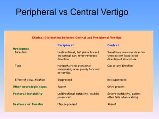 Peripheral vs Central Vertigo
 