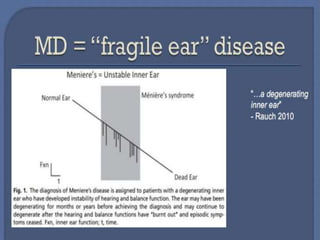 Vertigo and peripheral vestibular disorders