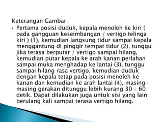 Keterangan Gambar :
 Pertama posisi duduk, kepala menoleh ke kiri (
pada gangguan keseimbangan / vertigo telinga
kiri ) (1), kemudian langsung tidur sampai kepala
menggantung di pinggir tempat tidur (2), tunggu
jika terasa berputar / vertigo sampai hilang,
kemudian putar kepala ke arah kanan perlahan
sampai muka menghadap ke lantai (3), tunggu
sampai hilang rasa vertigo, kemudian duduk
dengan kepala tetap pada posisi menoleh ke
kanan dan kemudian ke arah lantai (4), masing-
masing gerakan ditunggu lebih kurang 30 – 60
detik. Dapat dilakukan juga untuk sisi yang lain
berulang kali sampai terasa vertigo hilang.
 
