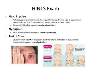 HINTS Exam
• Head Impulse
– Pt fixes eyes on examiner’s nose. Head quickly rotated. Normal side  eyes remain
fixated. Affected side  eyes make corrective saccade to fix on target
– Abnormal VOR reflex suggests peripheral pathology
• Nystagmus
– Vertical/bidirectional nystagmus = central pathology
• Test of Skew
– Cover/uncover test  pt focuses on examiner’s nose. Refixation of eyes/vertical
misalignment suggests central pathology
 