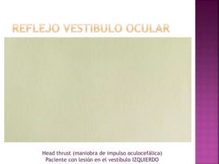 Head thrust (maniobra de impulso oculocefálica)
Paciente con lesión en el vestíbulo IZQUIERDO
 