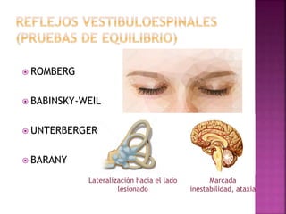  ROMBERG
 BABINSKY-WEIL
 UNTERBERGER
 BARANY
Lateralización hacia el lado
lesionado
Marcada
inestabilidad, ataxia
 