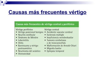 Causas más frecuentes vértigo
 