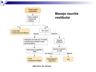 Manejo neuritis
vestibular
 