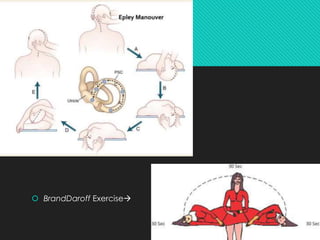 Vertigo Exercise .pdf Vertigo | PDF