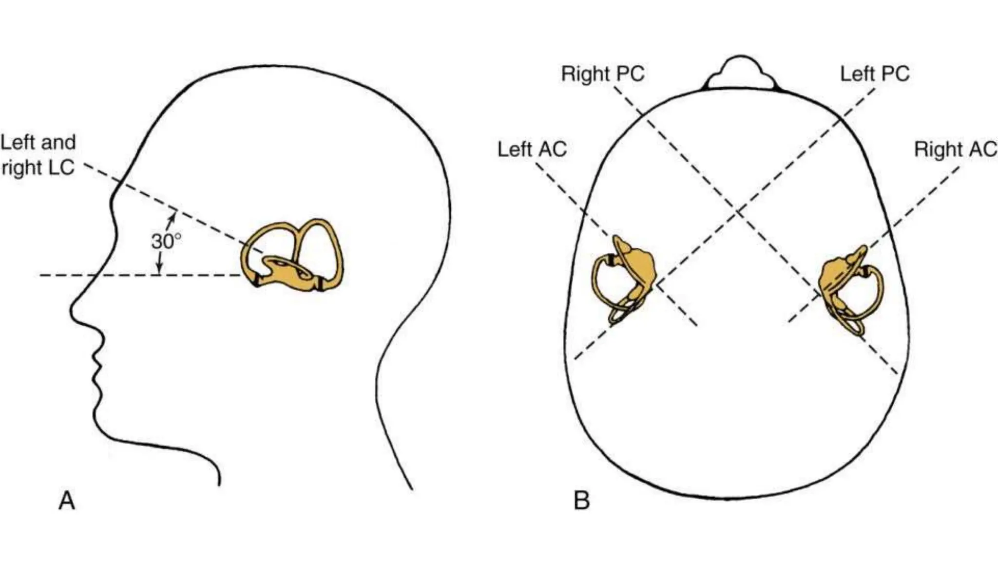 Vertigo and Nystagmus - Clinical approach.pptx