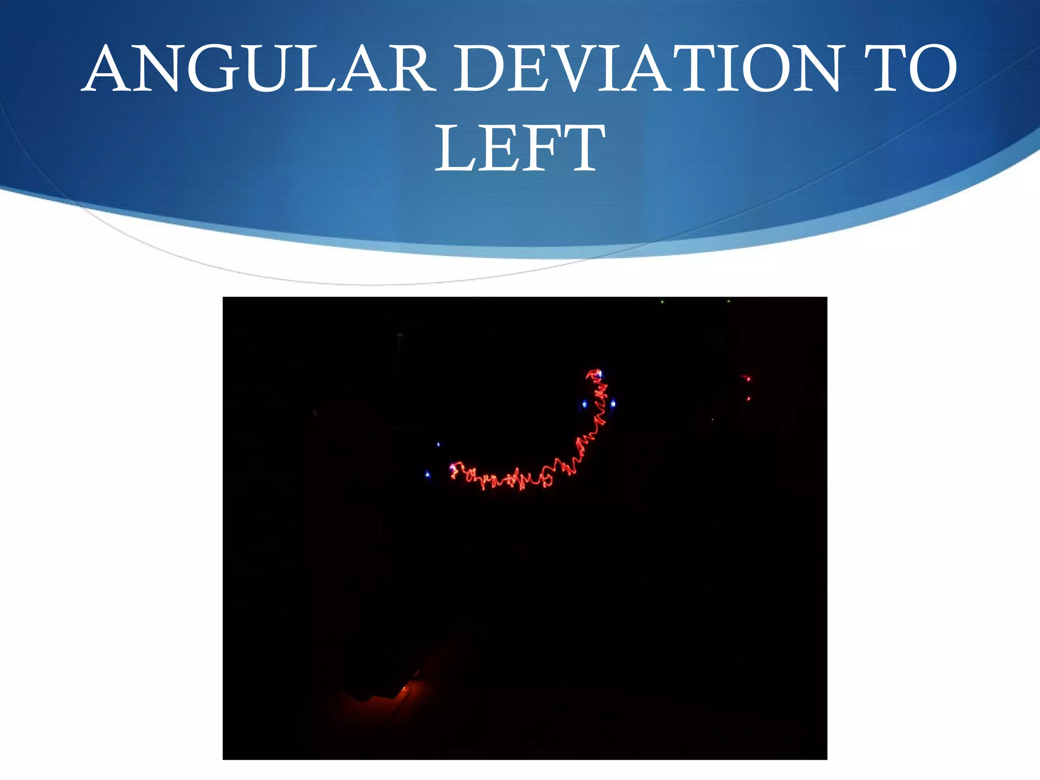 ANGULAR DEVIATION TO
LEFT
 