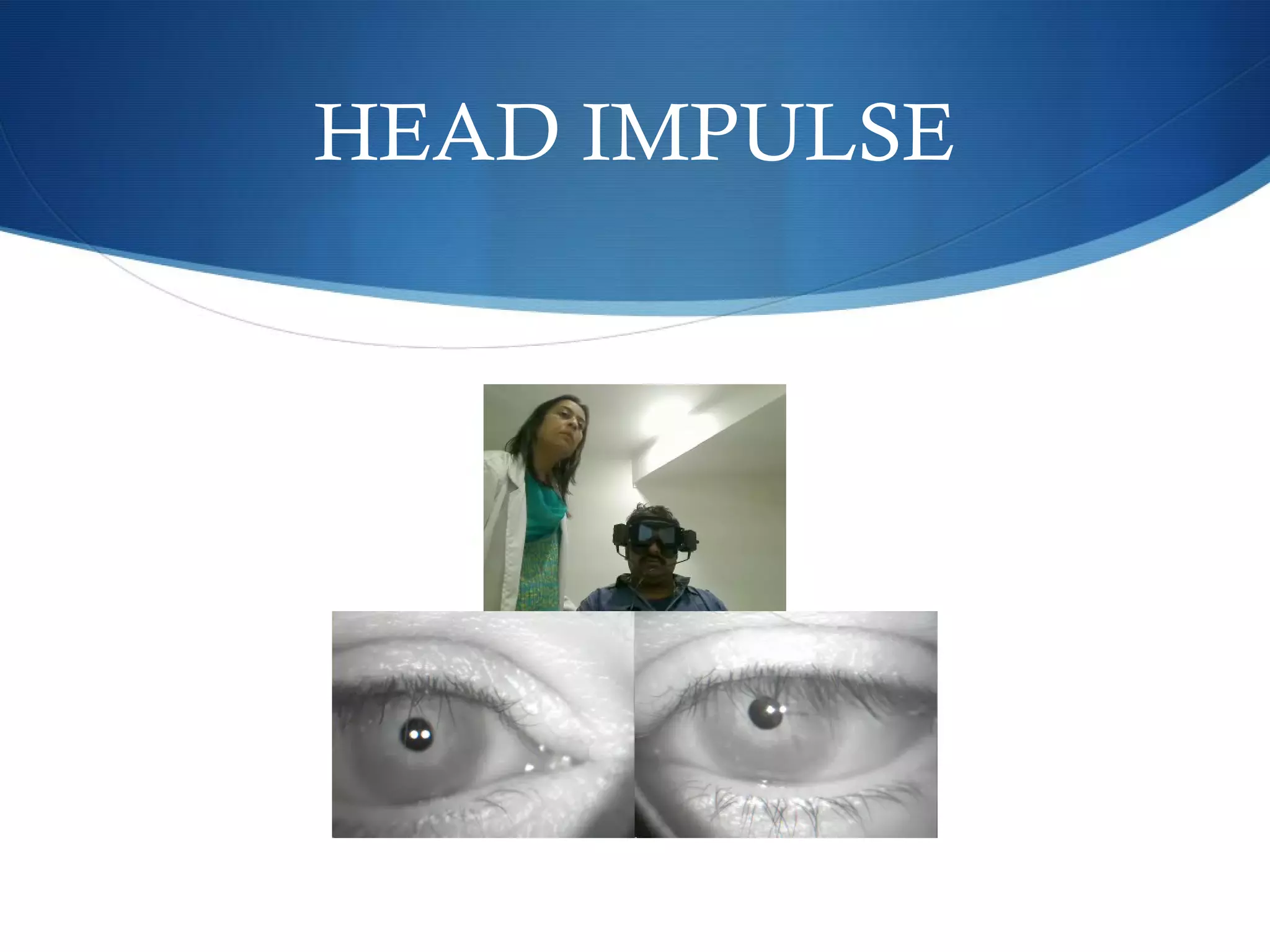 HEAD IMPULSE
 