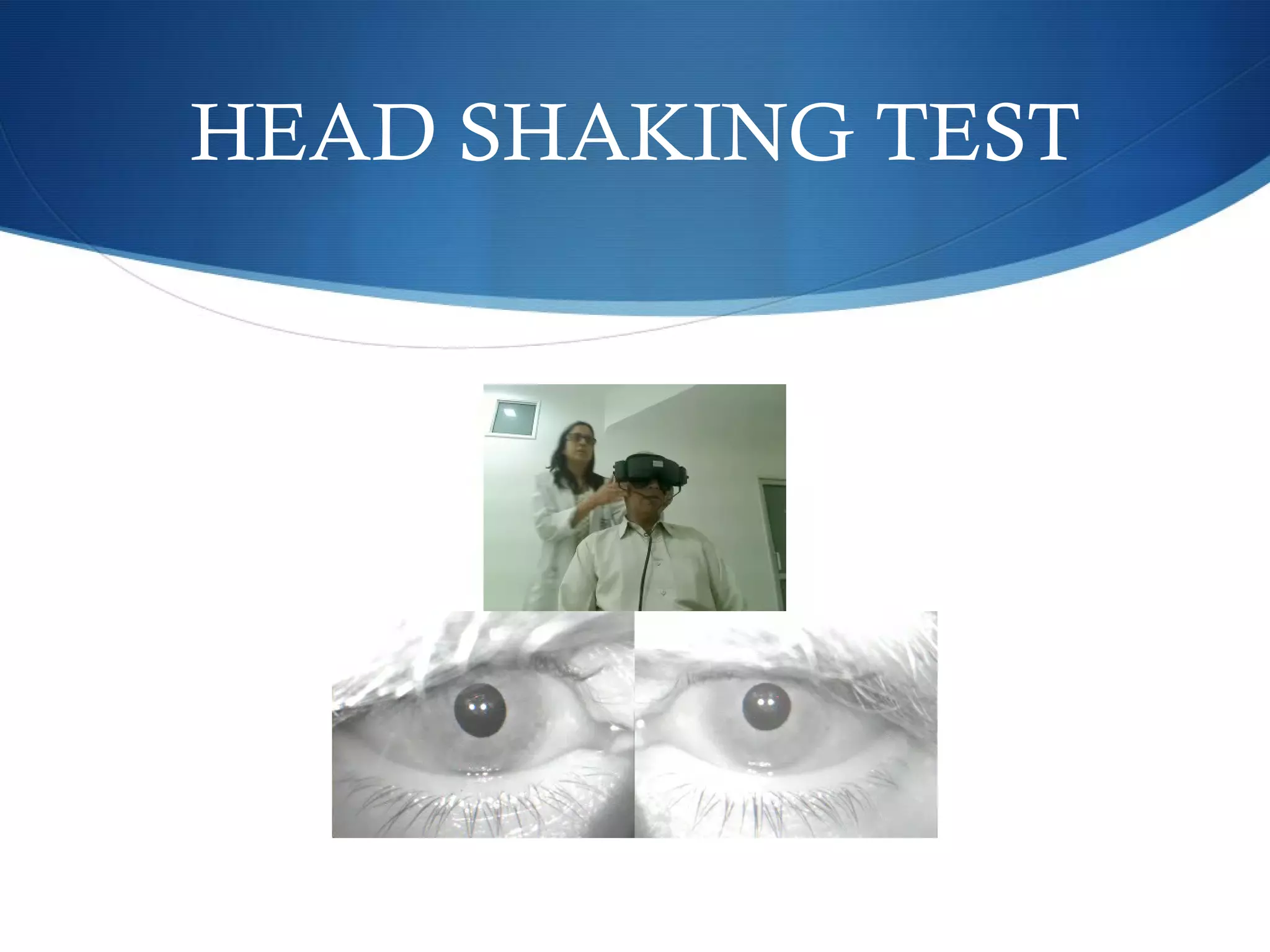 HEAD SHAKING TEST
 
