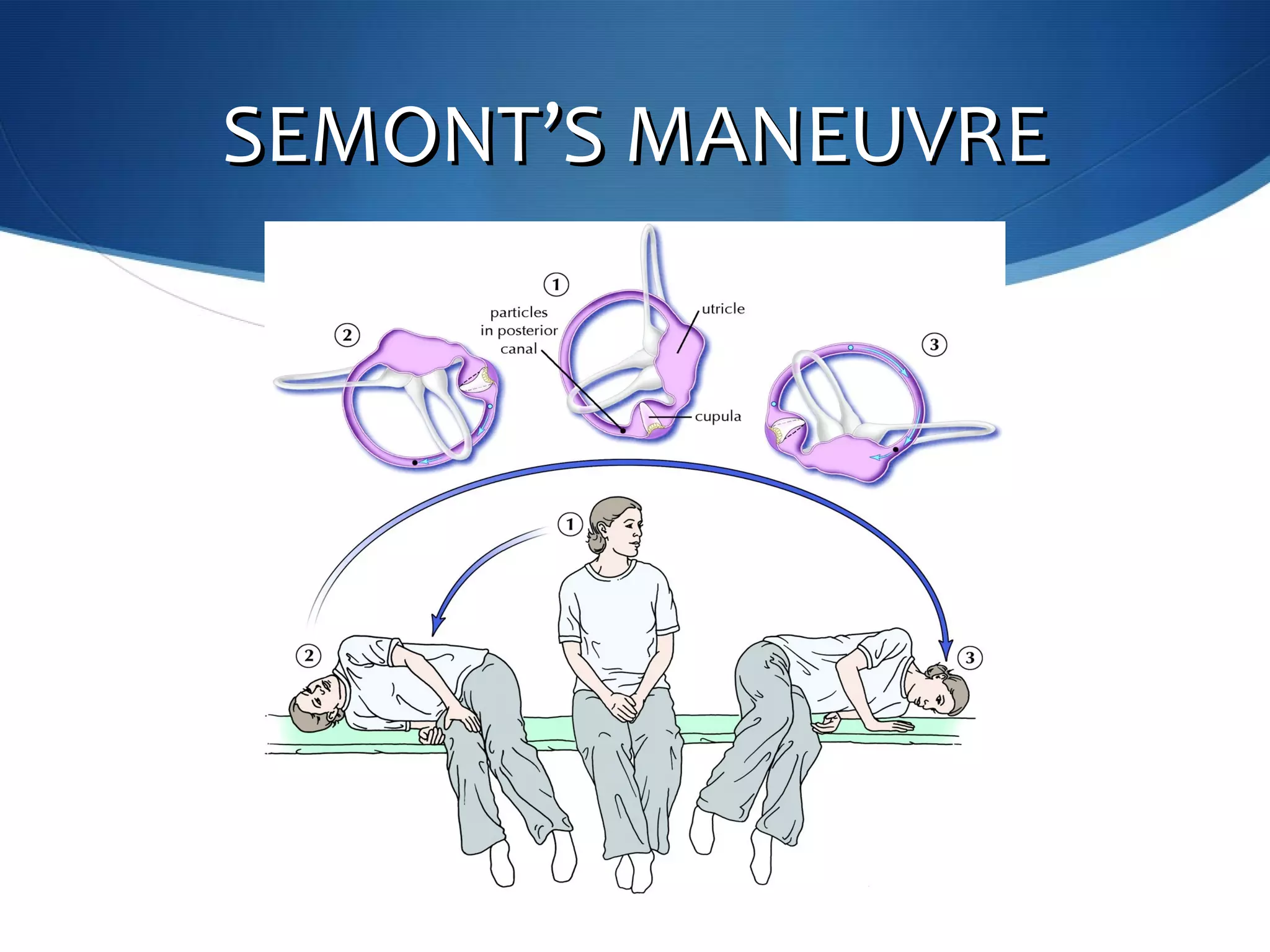 SEMONTSEMONT’’S MANEUVRES MANEUVRE
 