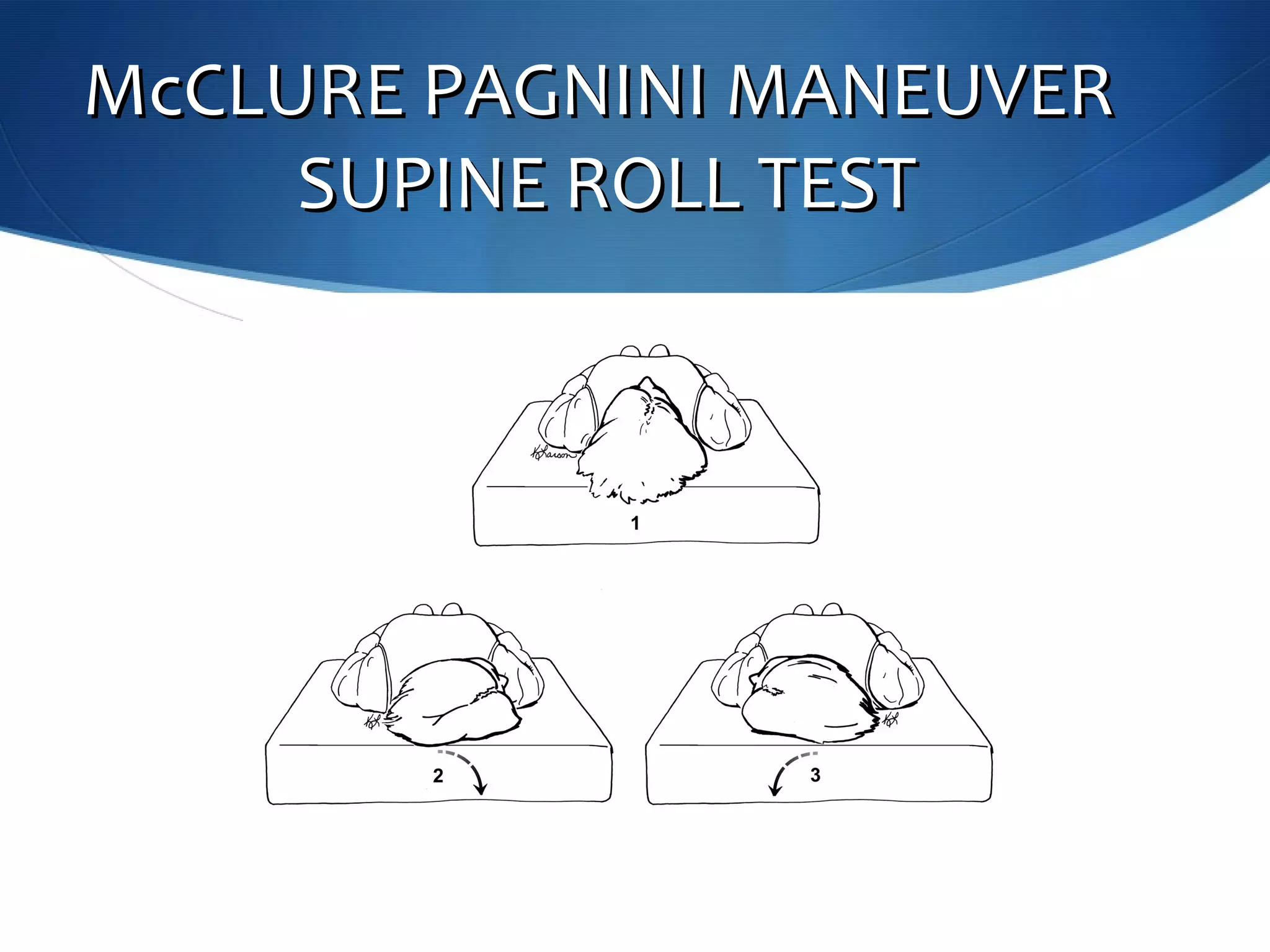 McCLURE PAGNINI MANEUVERMcCLURE PAGNINI MANEUVER
SUPINE ROLL TESTSUPINE ROLL TEST
 