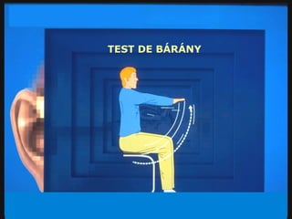 TEST DE BÁRÁNY 
