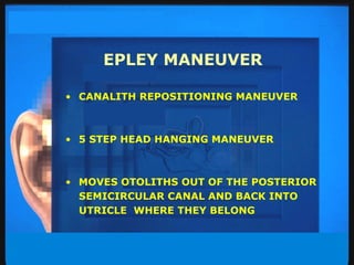 EPLEY MANEUVER CANALITH REPOSITIONING MANEUVER 5 STEP HEAD HANGING MANEUVER MOVES OTOLITHS OUT OF THE POSTERIOR SEMICIRCULAR CANAL AND BACK INTO  UTRICLE  WHERE THEY BELONG 