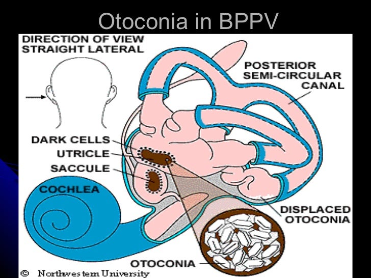 Vertigo and dizziness