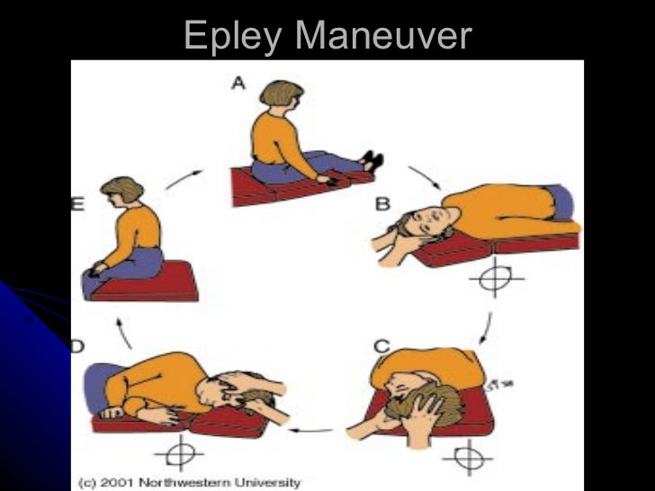 Do It Yourself Epley Maneuver
