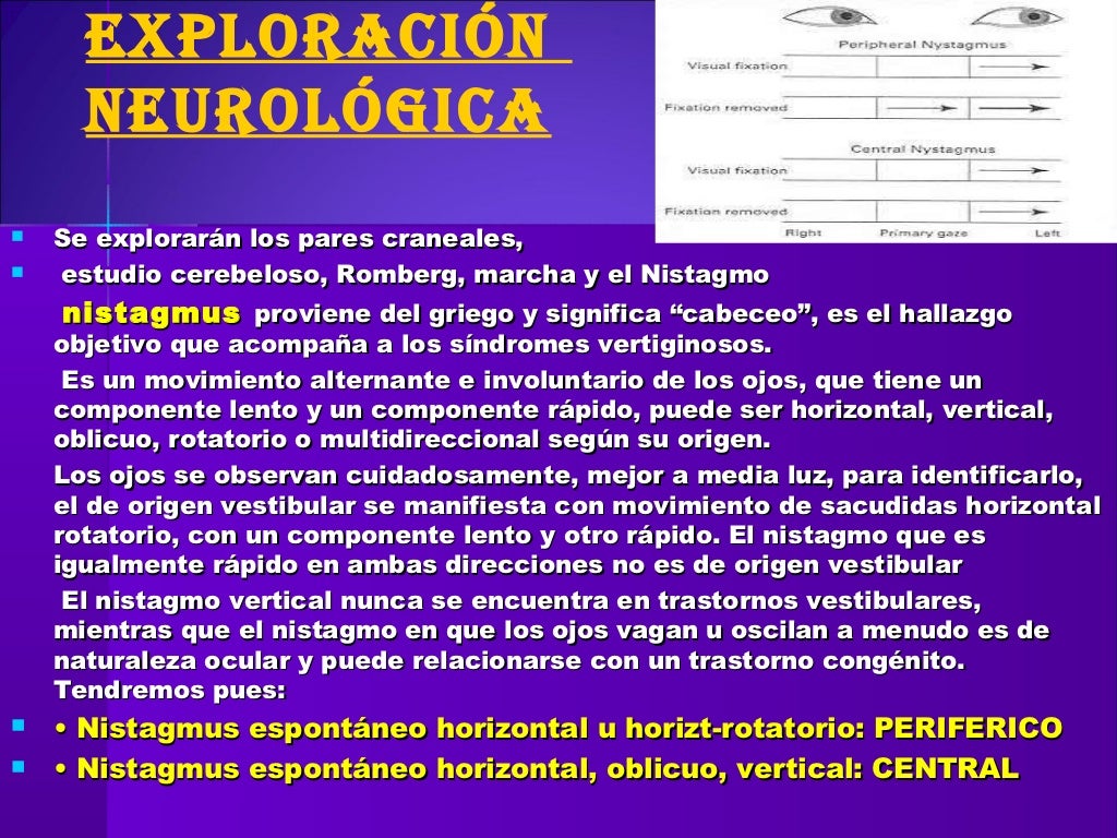  2012 11 15 Vertigo ppt 
