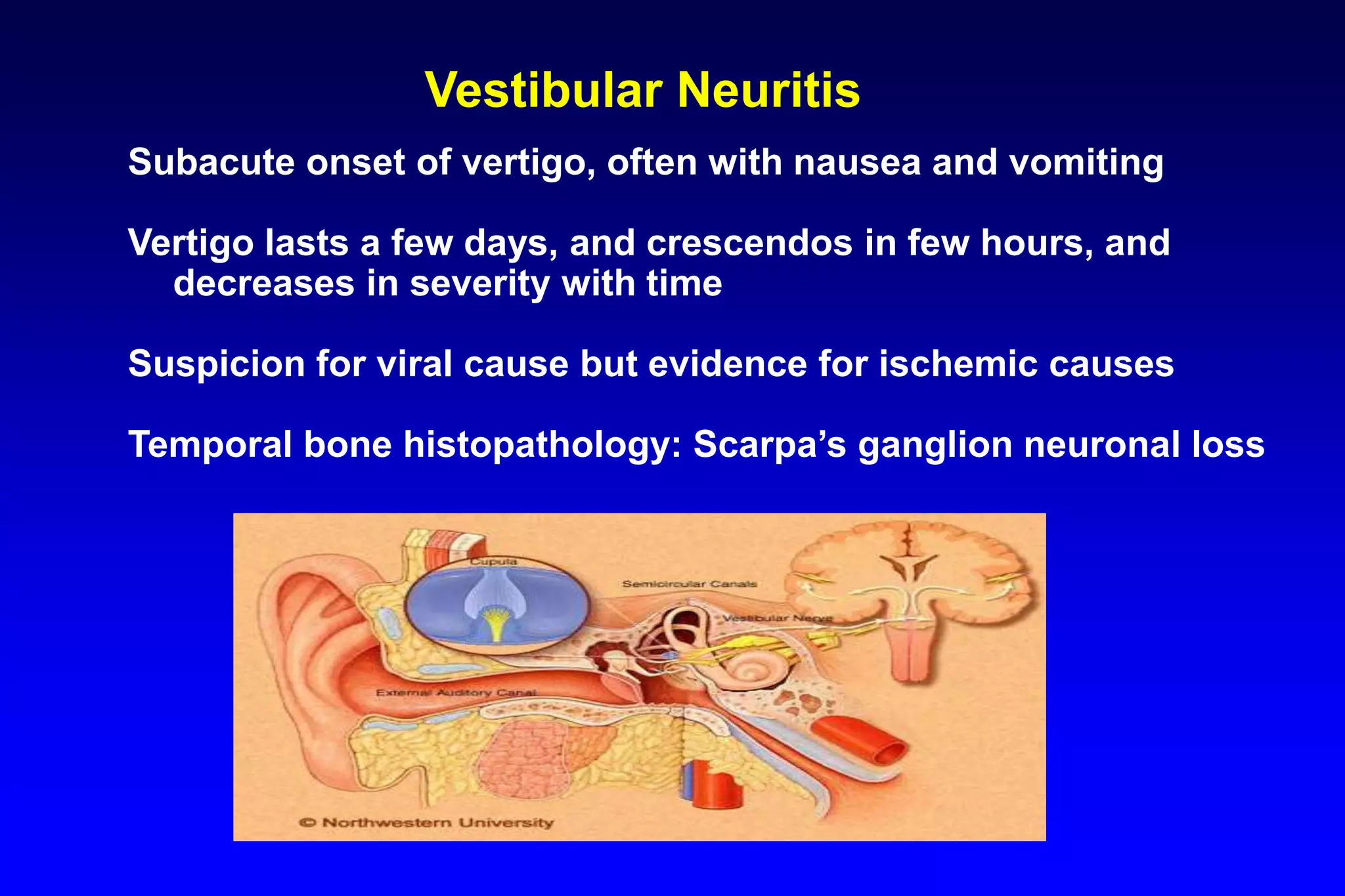 Vertigo & Dizziness: Diagnosis, Management | PPT