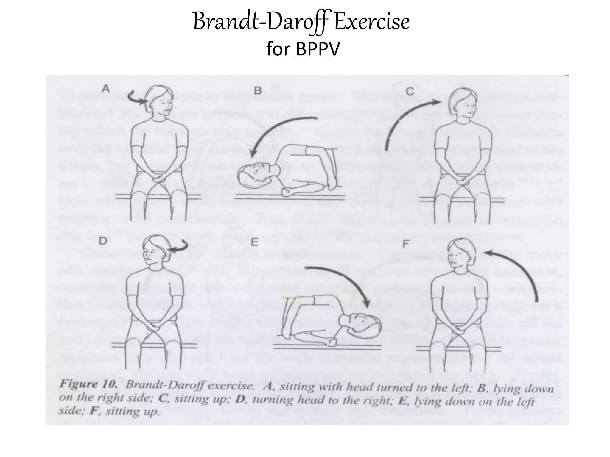 Vertigo Work up & management pptx.pptx