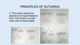 4. The suture should be
placed at an equal distance
from the incision on both
sides and at equal depth.
PRINCIPLES OF SUTURING
 