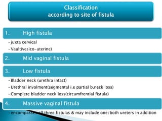 1. High fistula
•juxta cervical
•Vault(vesico-uterine)
2. Mid vaginal fistula
3. Low fistula
•Bladder neck (urethra intact)
•Urethral involment(segmental i.e partial b.neck loss)
•Complete bladder neck loss(circumfrential fistula)
4. Massive vaginal fistula
•encompasses all three fistulas & may include one/both ureters in addition
Classification
according to site of fistula
 