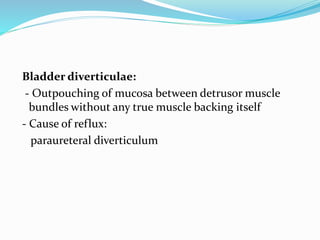 Bladder diverticulae:
- Outpouching of mucosa between detrusor muscle
bundles without any true muscle backing itself
- Cause of reflux:
paraureteral diverticulum
 
