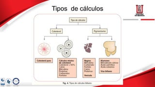Tipos de cálculos
 