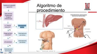 Algoritmo de
procedimiento
 
