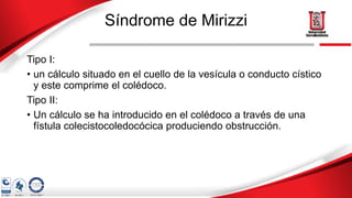 Síndrome de Mirizzi
Tipo I:
• un cálculo situado en el cuello de la vesícula o conducto cístico
y este comprime el colédoco.
Tipo II:
• Un cálculo se ha introducido en el colédoco a través de una
fístula colecistocoledocócica produciendo obstrucción.
 