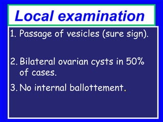 Local examination
1. Passage of vesicles (sure sign).


2. Bilateral ovarian cysts in 50%
   of cases.
3. No internal ballottement.
 