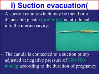 I) Suction evacuation(
- A suction canula which may be metal or a
  disposable plastic (preferred) is introduced
  into the uterine cavity.




- The canula is connected to a suction pump
  adjusted at negative pressure of 300-500
  mmHg according to the duration of pregnancy
 