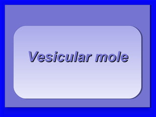 Vesicular mole
Vesicular mole

Vesicular mole
Vesicular mole
 