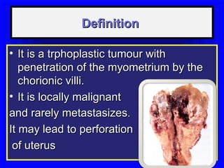 Definition

• It is a trphoplastic tumour with
   penetration of the myometrium by the
   chorionic villi.
• It is locally malignant
and rarely metastasizes.
It may lead to perforation
 of uterus
 