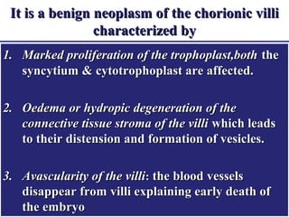 It is a benign neoplasm of the chorionic villi
                characterized by
1. Marked proliferation of the trophoplast,both the
   syncytium & cytotrophoplast are affected.

2. Oedema or hydropic degeneration of the
   connective tissue stroma of the villi which leads
   to their distension and formation of vesicles.

3. Avascularity of the villi: the blood vessels
   disappear from villi explaining early death of
   the embryo
 