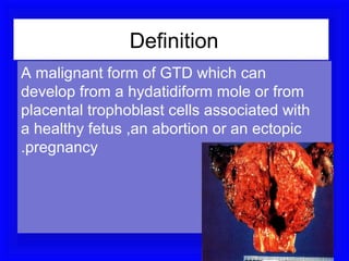 Definition
A malignant form of GTD which can
develop from a hydatidiform mole or from
placental trophoblast cells associated with
a healthy fetus ,an abortion or an ectopic
.pregnancy
 