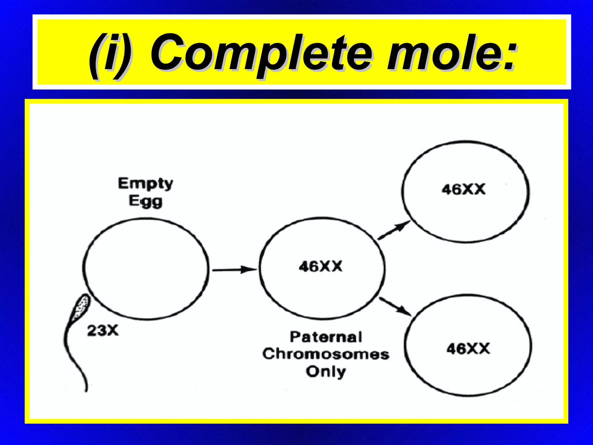 (i) Complete mole: 