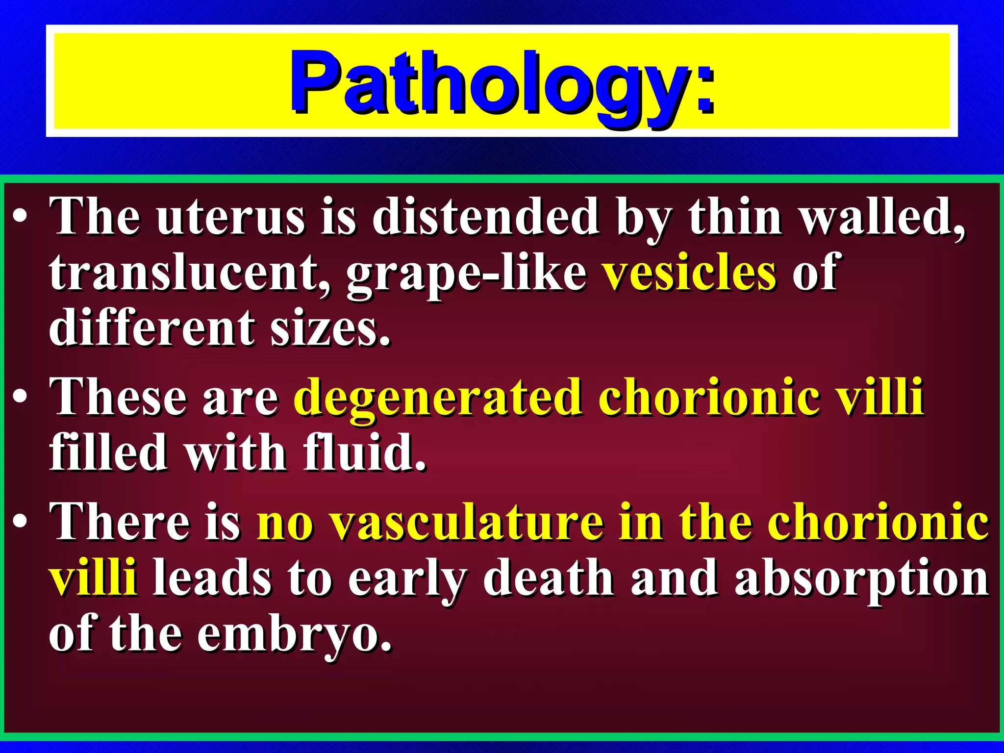 Pathology: The uterus is distended by thin walled, translucent, grape-like  vesicles  of different sizes.  These are  degenerated chorionic villi  filled with fluid. There is  no vasculature in the chorionic villi  leads to early death and absorption of the embryo. 