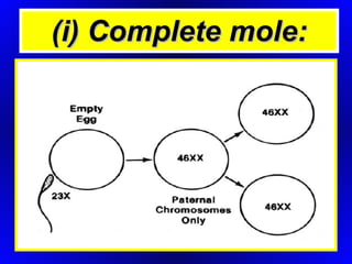 (i) Complete mole: 