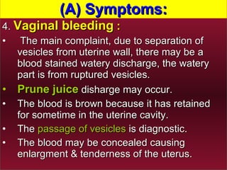 4.  Vaginal bleeding  : The main complaint, due to separation of vesicles from uterine wall, there may be a blood stained watery discharge, the watery part is from ruptured vesicles. Prune juice  disharge may occur.  The blood is brown because it has retained for sometime in the uterine cavity.  The  passage of vesicles  is diagnostic.  The blood may be concealed causing enlargment & tenderness of the uterus.  (A) Symptoms: 
