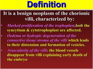 Definition It is a benign neoplasm of the chorionic villi, characterized by: Marked proliferation of the trophoplast, both   the syncytium & cytotrophoplast are affected. Oedema or hydropic degeneration of the connective tissue stroma of the villi  which leads to their distension and formation of vesicles. Avascularity of the villi :  the blood vessels disappear from villi explaining early death of the embryo 