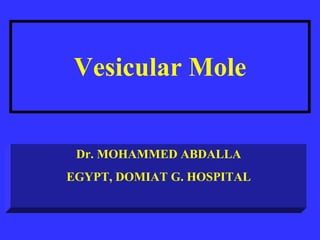 Vesicular Mole Dr. MOHAMMED ABDALLA EGYPT, DOMIAT G. HOSPITAL 
