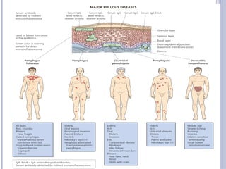Bullous Process VESICULAR AND BULLOUS LESIONS OF SKIN (2).pptx