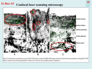 58
Confocal laser scanning microscopy11-Dec-15
 