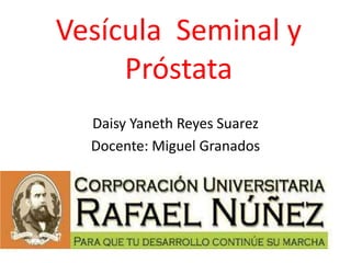 Vesícula Seminal y 
Próstata 
Daisy Yaneth Reyes Suarez 
Docente: Miguel Granados 
 