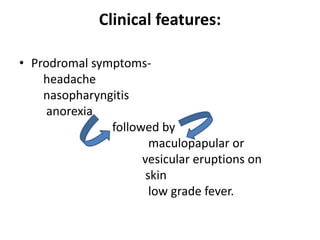 Clinical features:
• Prodromal symptoms-
headache
nasopharyngitis
anorexia
followed by
maculopapular or
vesicular eruptions on
skin
low grade fever.
 
