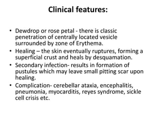 Clinical features:
• Dewdrop or rose petal - there is classic
penetration of centrally located vesicle
surrounded by zone of Erythema.
• Healing – the skin eventually ruptures, forming a
superficial crust and heals by desquamation.
• Secondary infection- results in formation of
pustules which may leave small pitting scar upon
healing.
• Complication- cerebellar ataxia, encephalitis,
pneumonia, myocarditis, reyes syndrome, sickle
cell crisis etc.
 