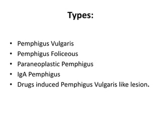 Types:
• Pemphigus Vulgaris
• Pemphigus Foliceous
• Paraneoplastic Pemphigus
• IgA Pemphigus
• Drugs induced Pemphigus Vulgaris like lesion.
 
