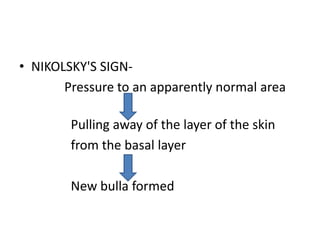 • NIKOLSKY'S SIGN-
Pressure to an apparently normal area
Pulling away of the layer of the skin
from the basal layer
New bulla formed
 